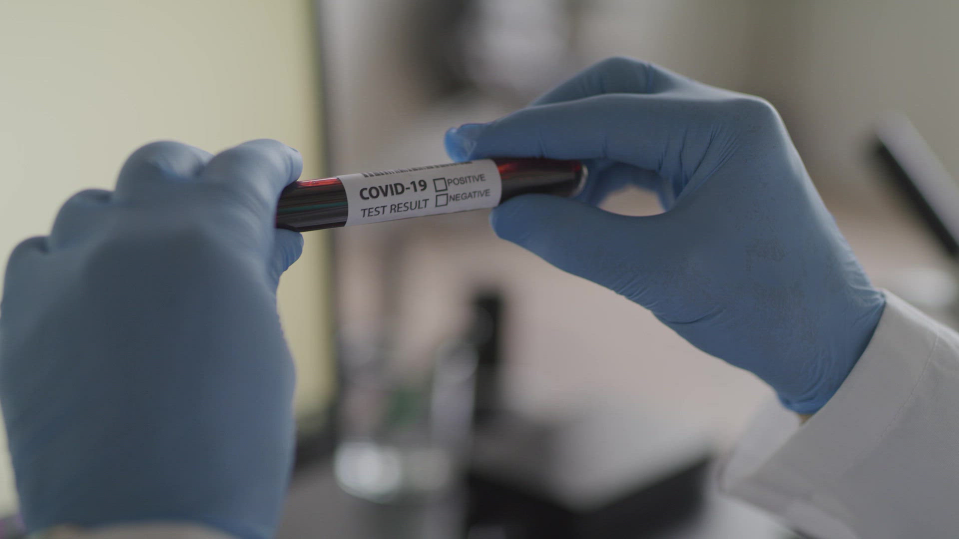 Scientist Examining Blood Test FILMPAC